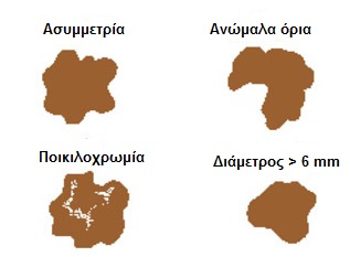 ABCS
